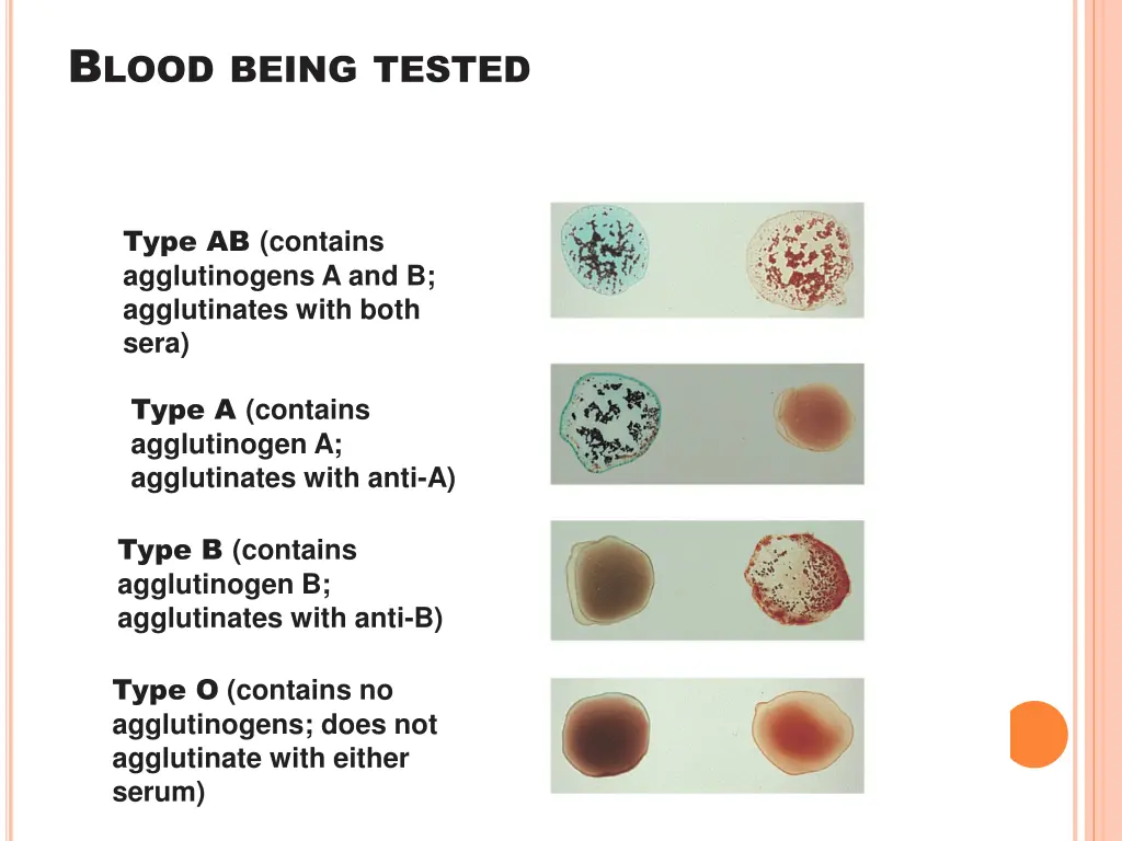 b lood being tested