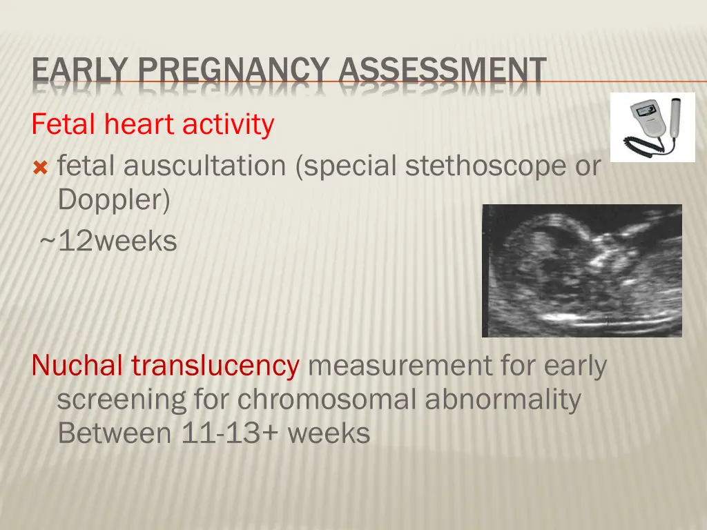 early pregnancy assessment