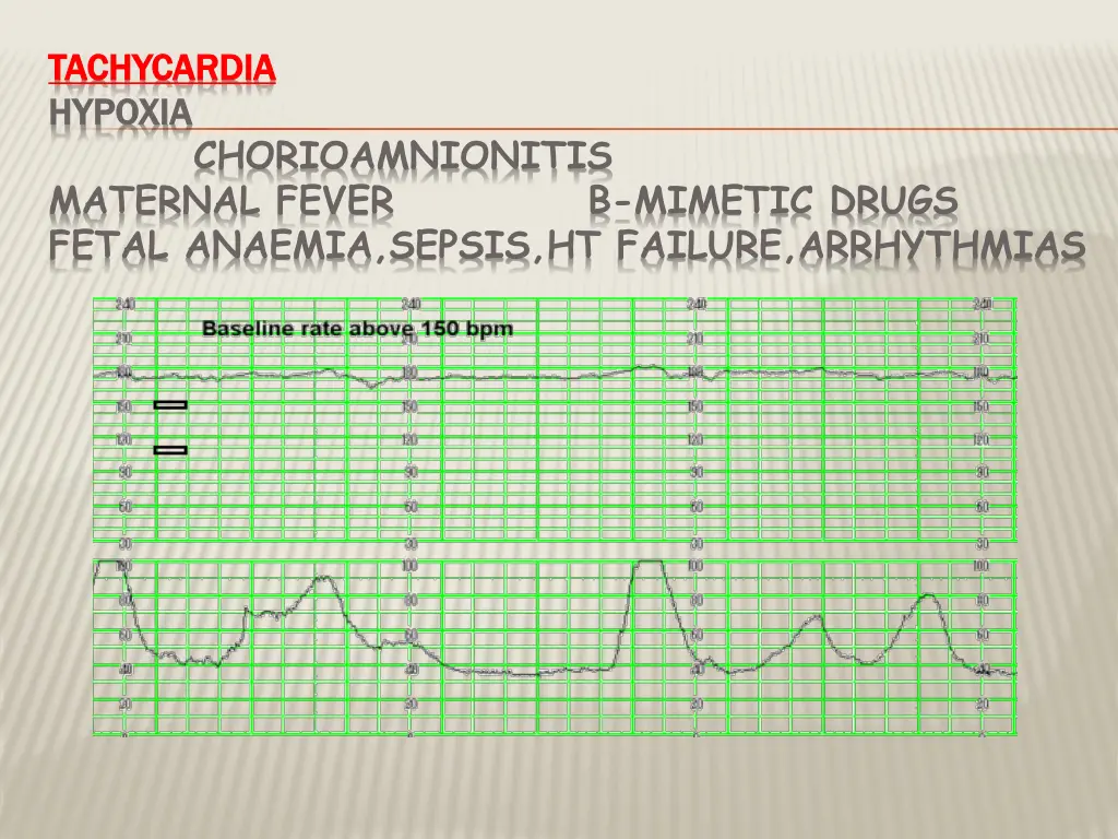 tachycardia tachycardia hypoxia hypoxia