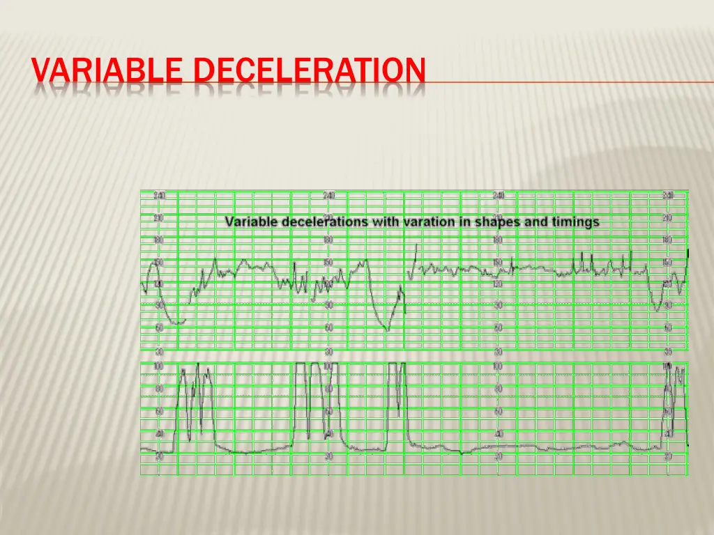 variable deceleration