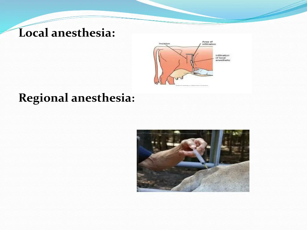 local anesthesia