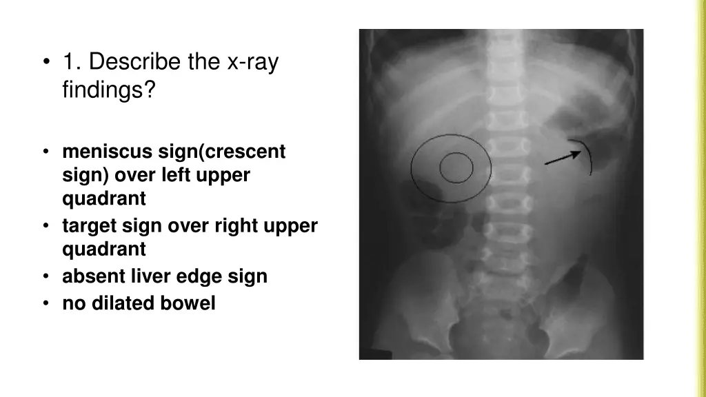 1 describe the x ray findings