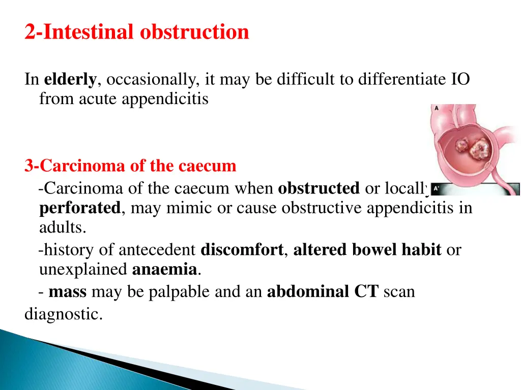 2 intestinal obstruction in elderly occasionally