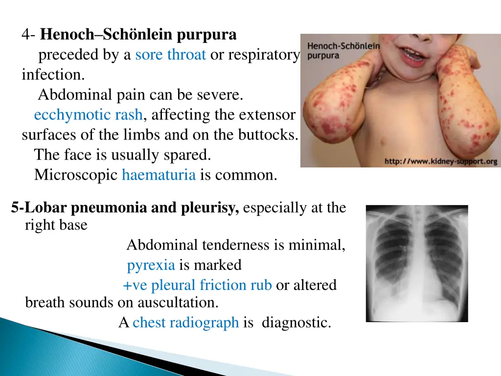 4 henoch sch nlein purpura preceded by a sore