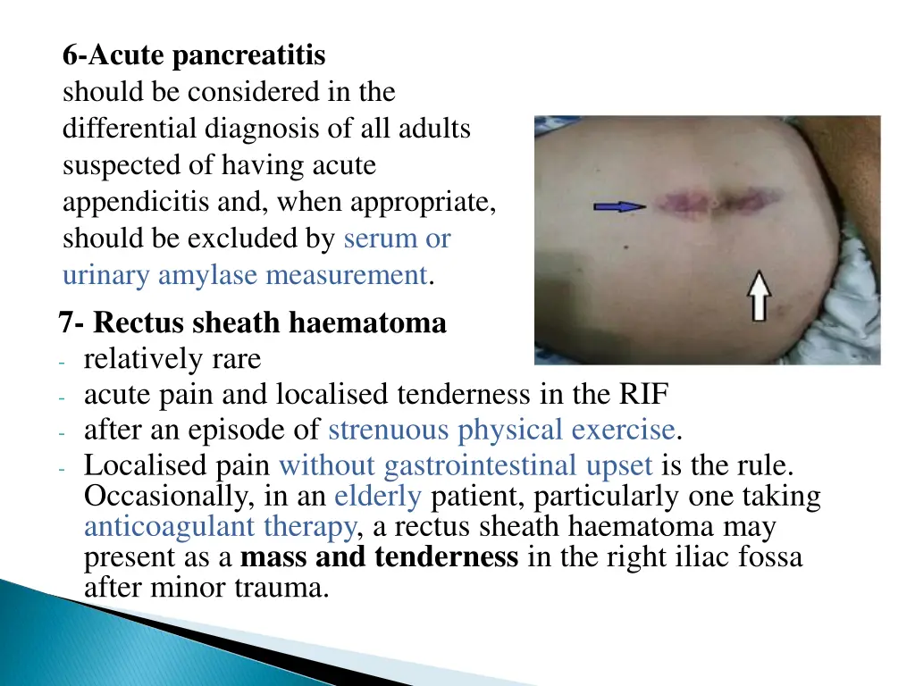 6 acute pancreatitis should be considered