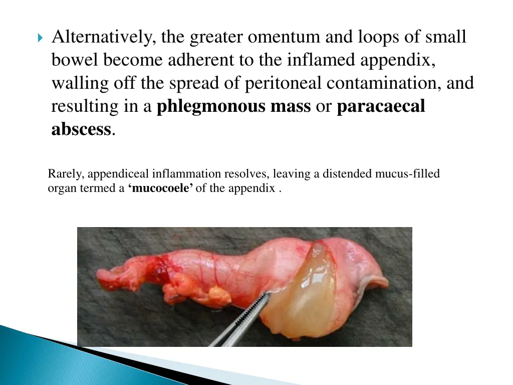 alternatively the greater omentum and loops