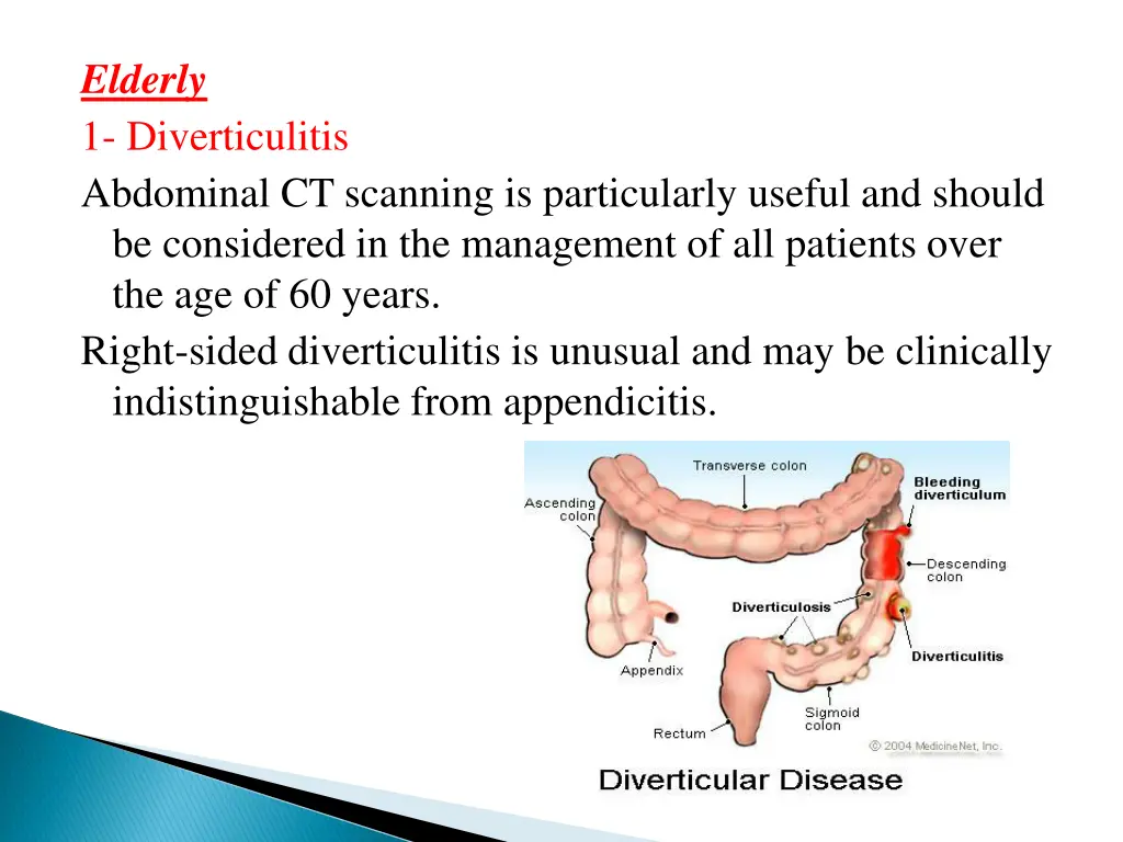 elderly 1 diverticulitis abdominal ct scanning