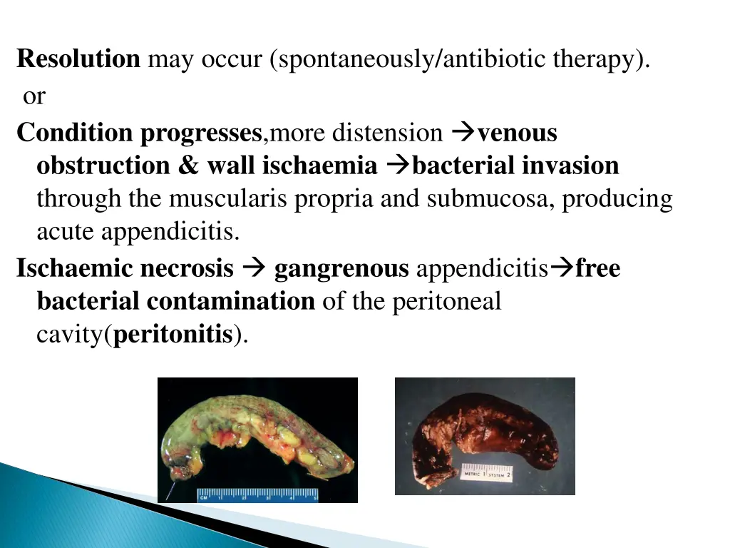 resolution may occur spontaneously antibiotic