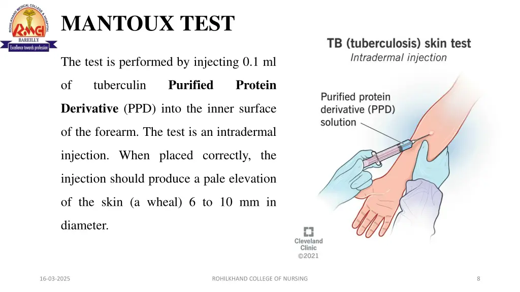 mantoux test
