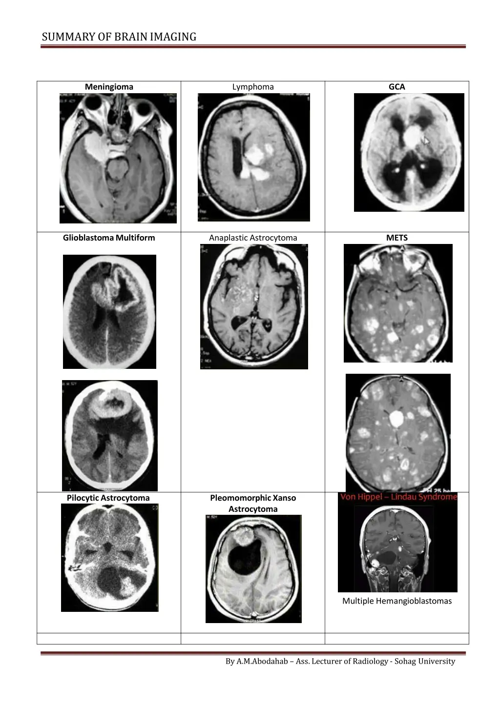 summary of brainimaging 5