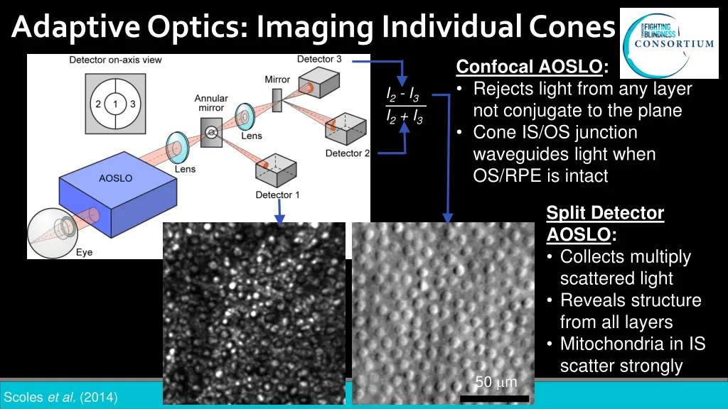 adaptive optics imaging individual cones