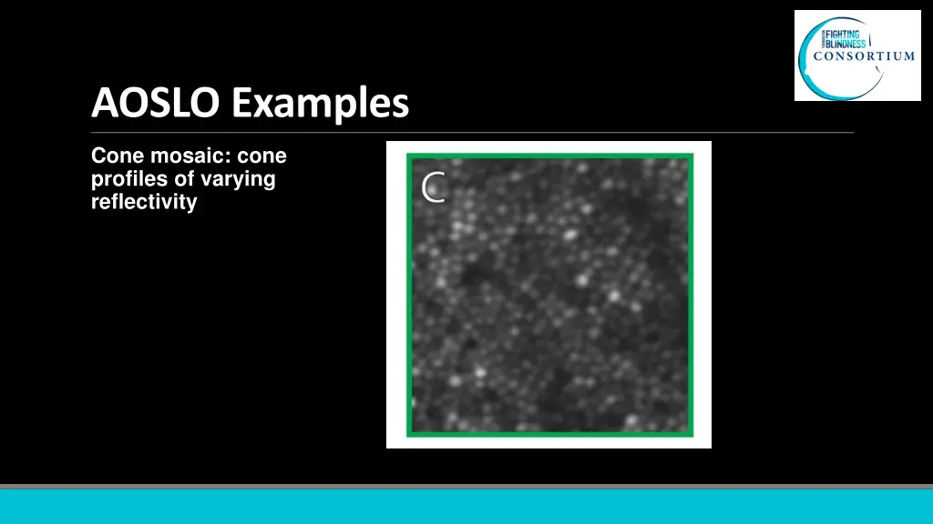 aoslo examples 1