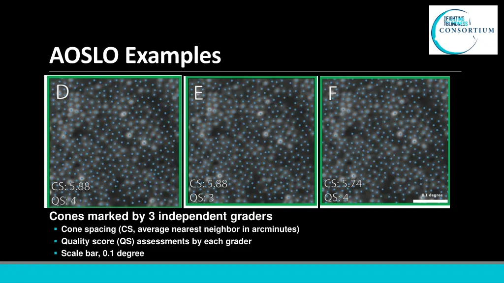 aoslo examples 2