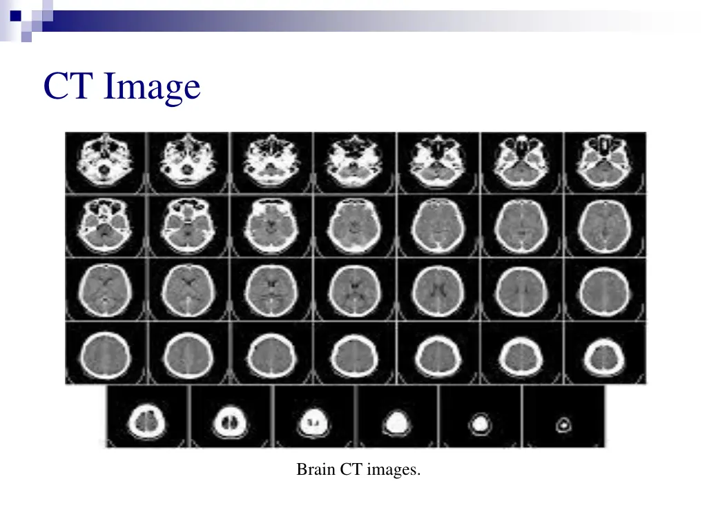 ct image