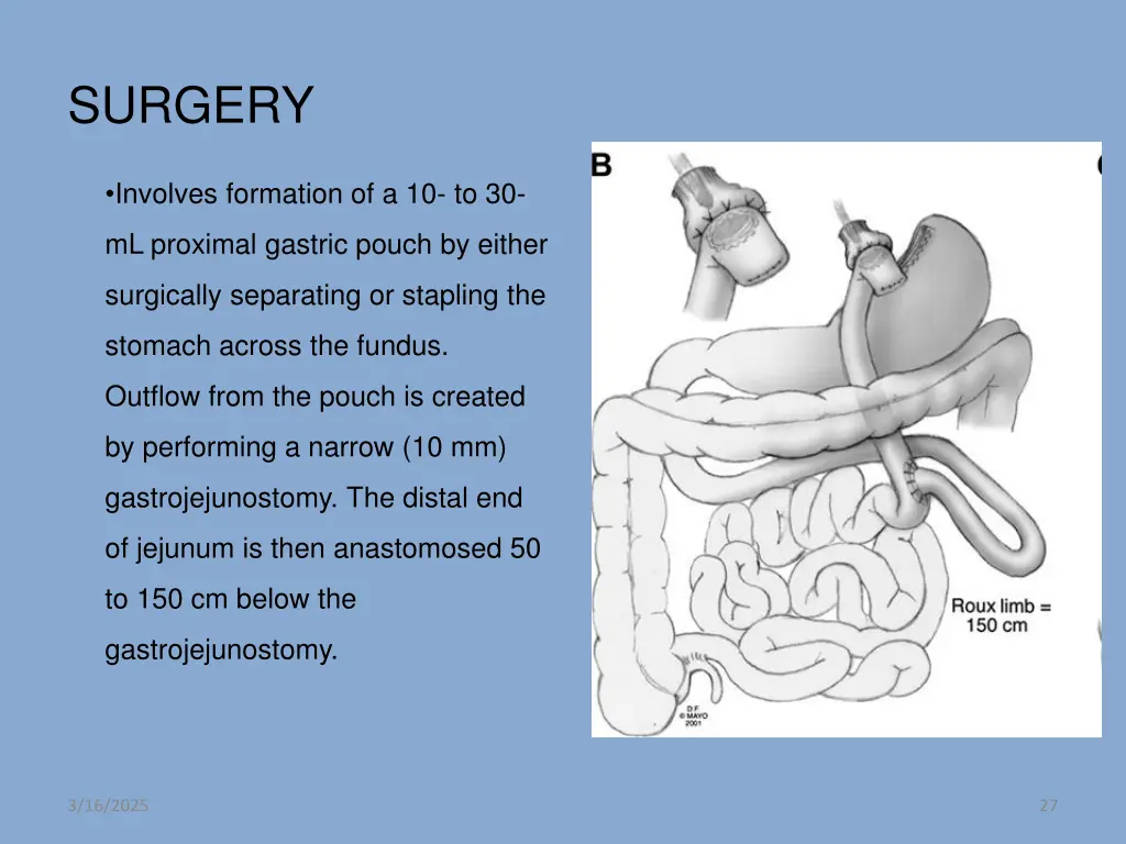 surgery 3