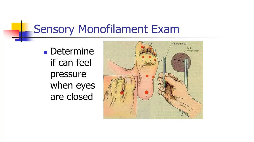 sensory monofilament exam