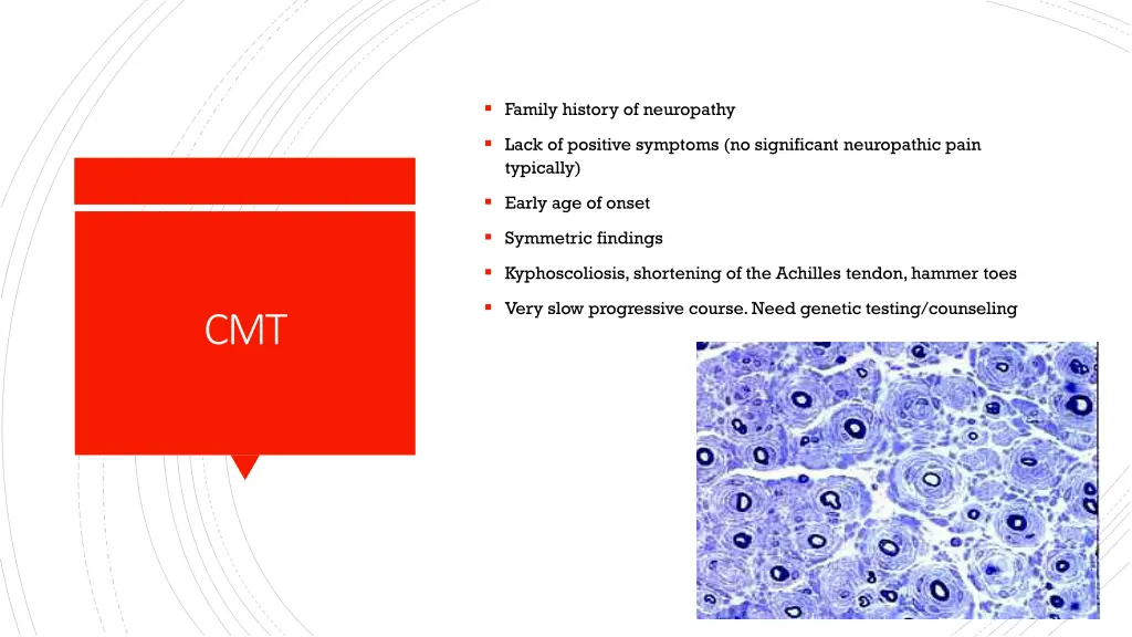 family history of neuropathy