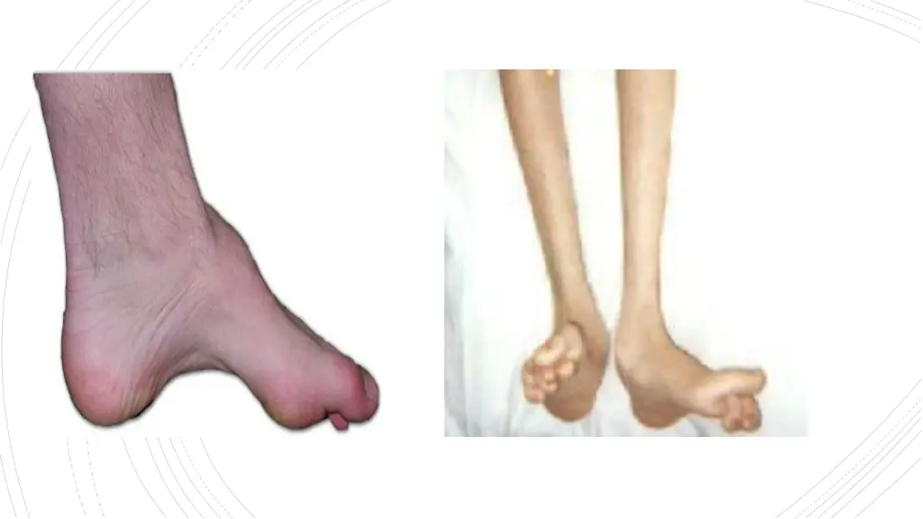 slide23