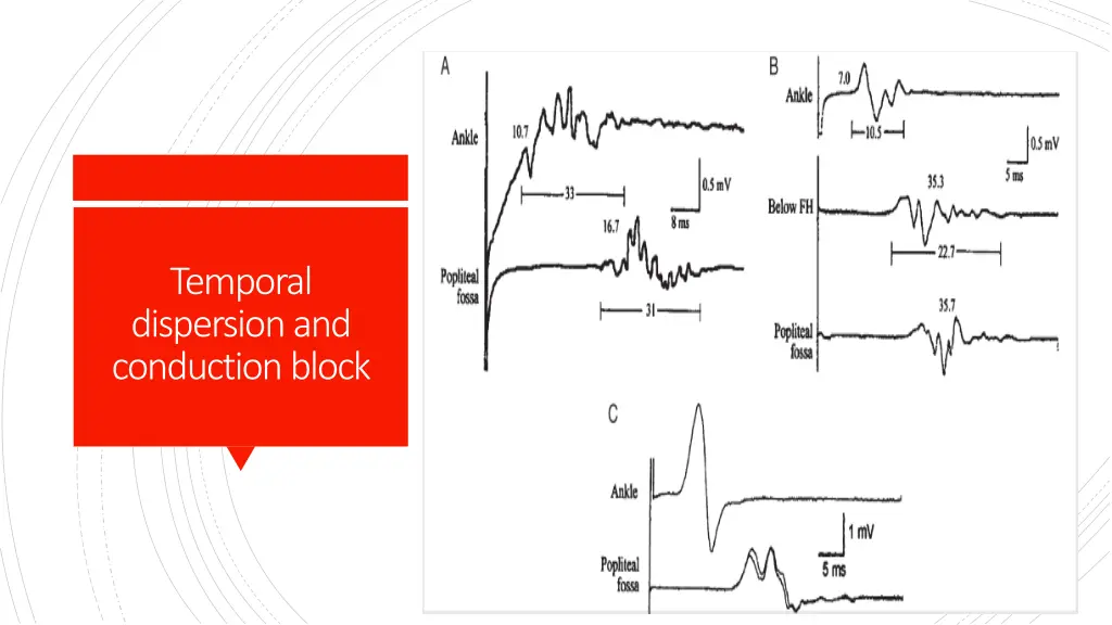 temporal dispersion and conduction block
