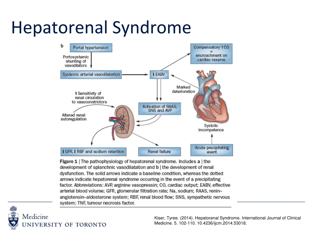 hepatorenal syndrome 1