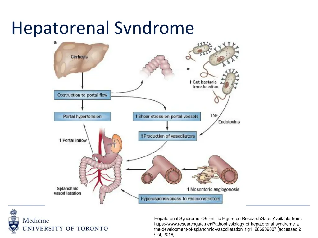hepatorenal syndrome