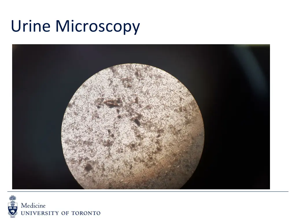 urine microscopy