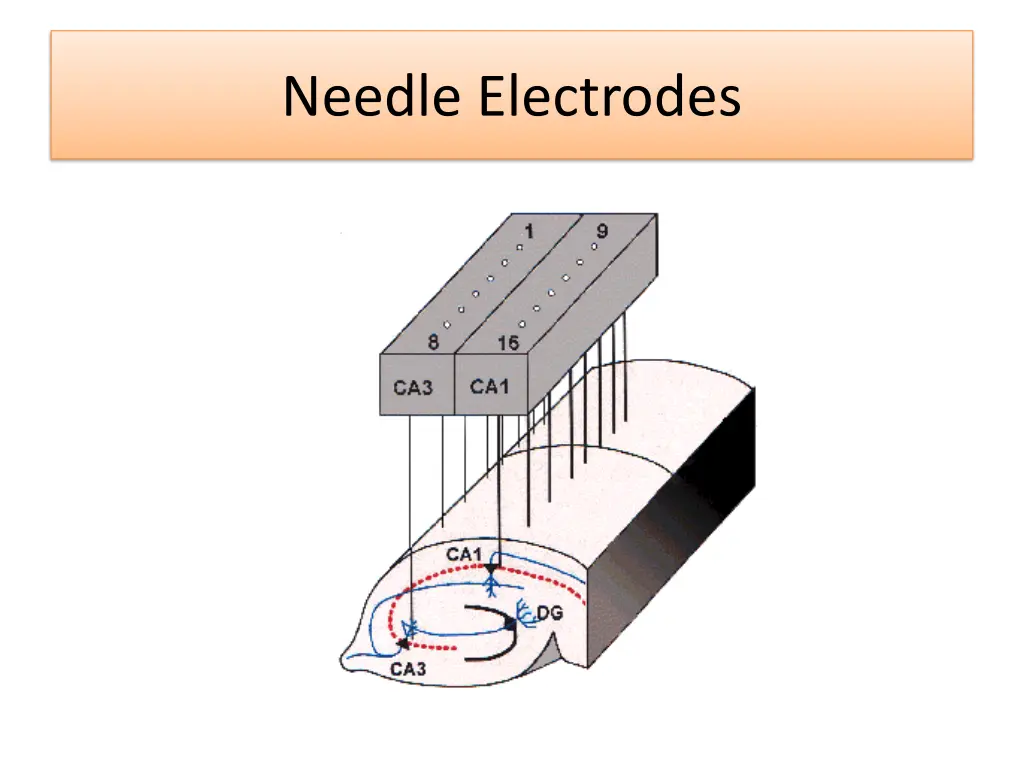 needle electrodes 3