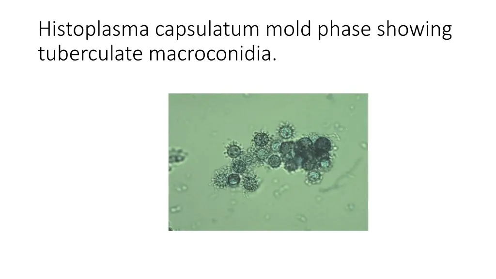 histoplasma capsulatum mold phase showing