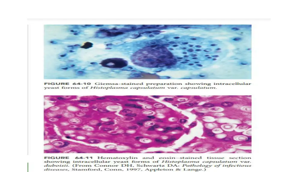 slide5