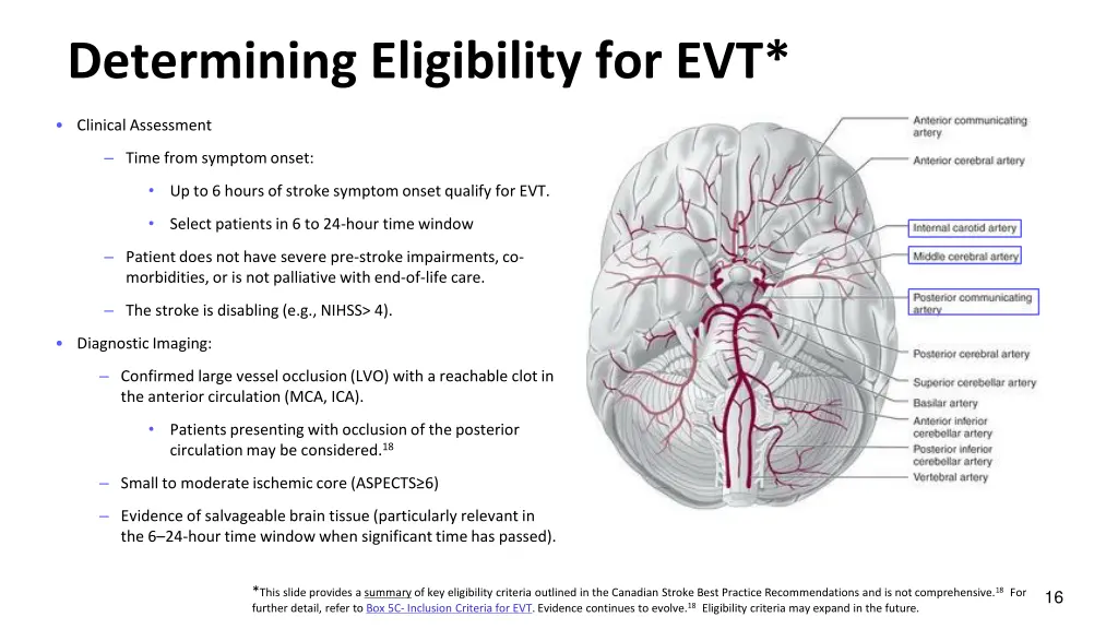 determining eligibility for evt