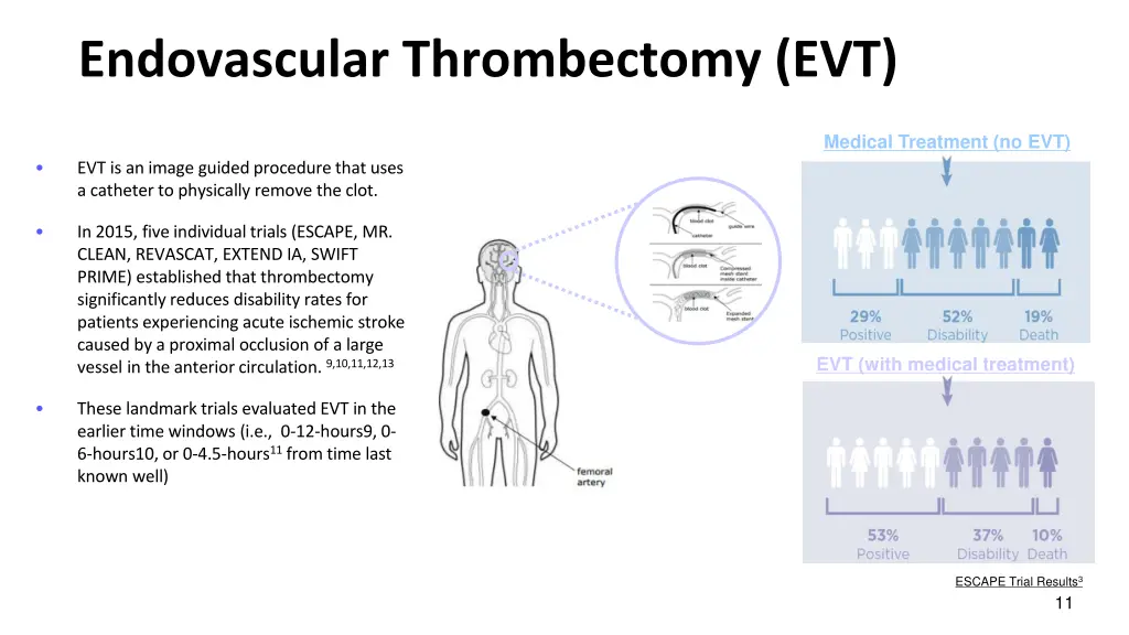 endovascular thrombectomy evt