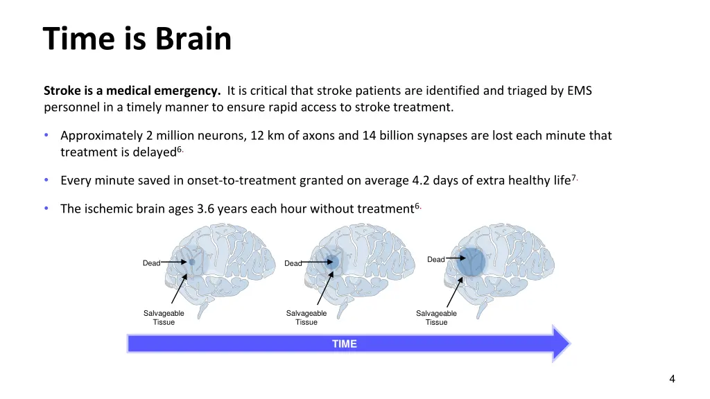 time is brain