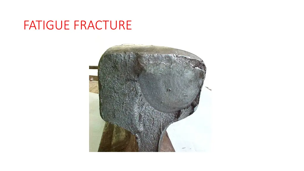 fatigue fracture 1