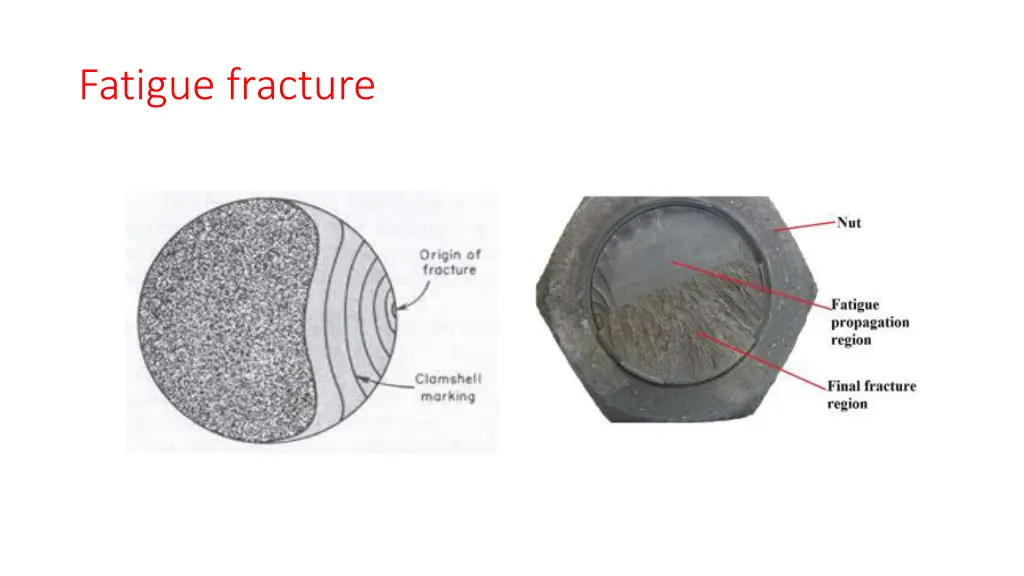 fatigue fracture