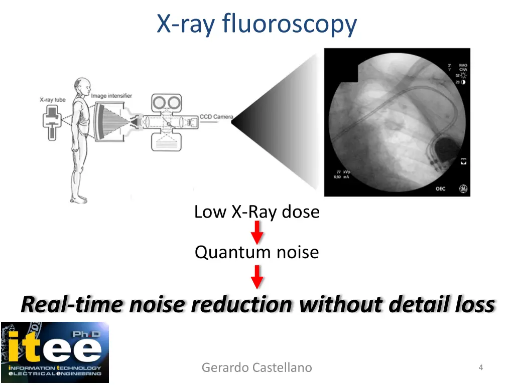 x ray fluoroscopy