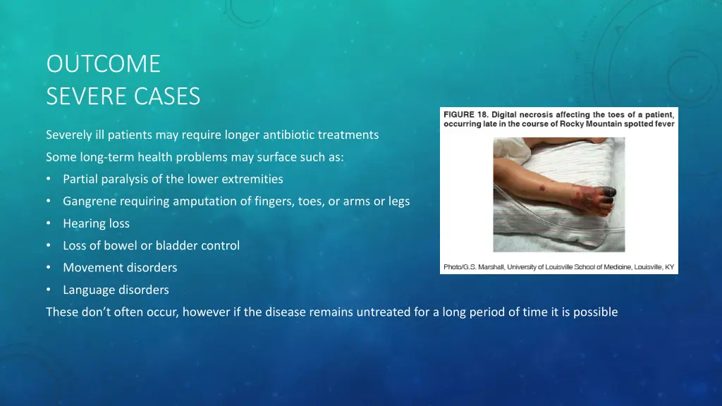 outcome severe cases