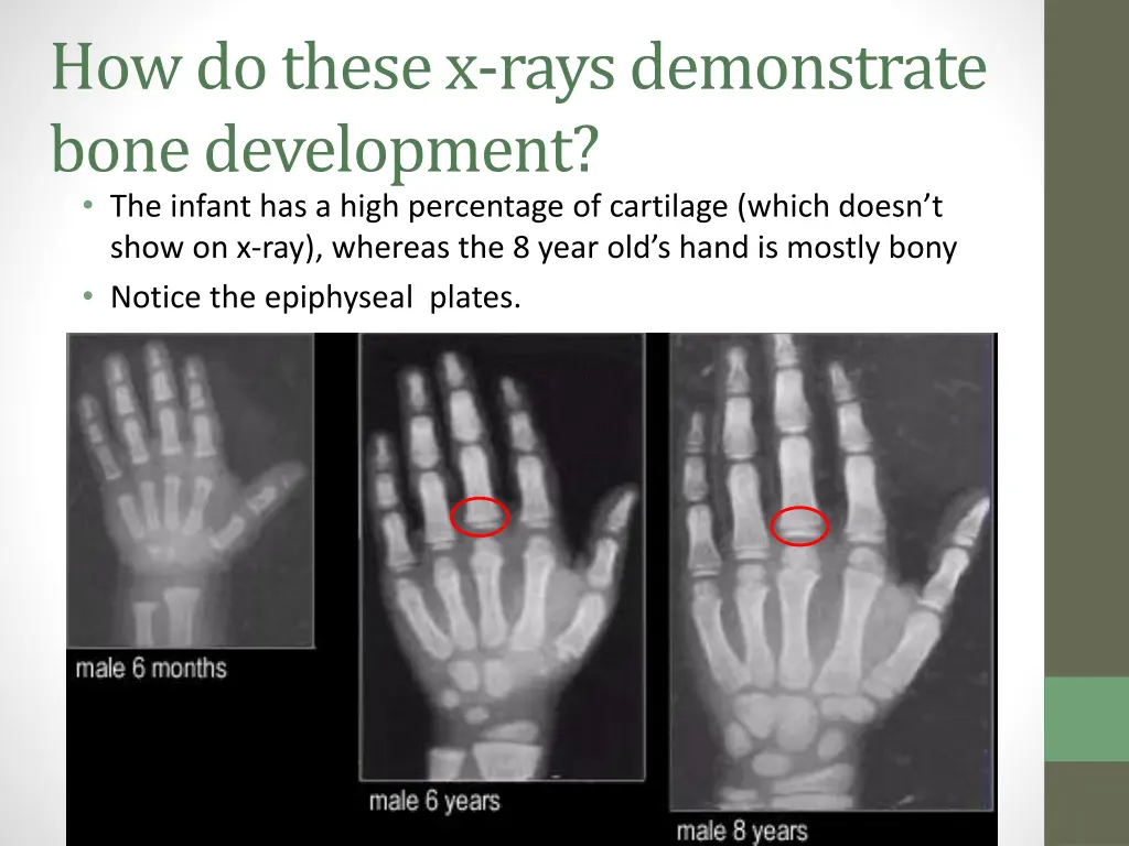 how do these x rays demonstrate bone development 1