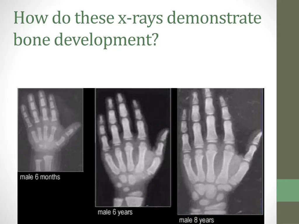 how do these x rays demonstrate bone development