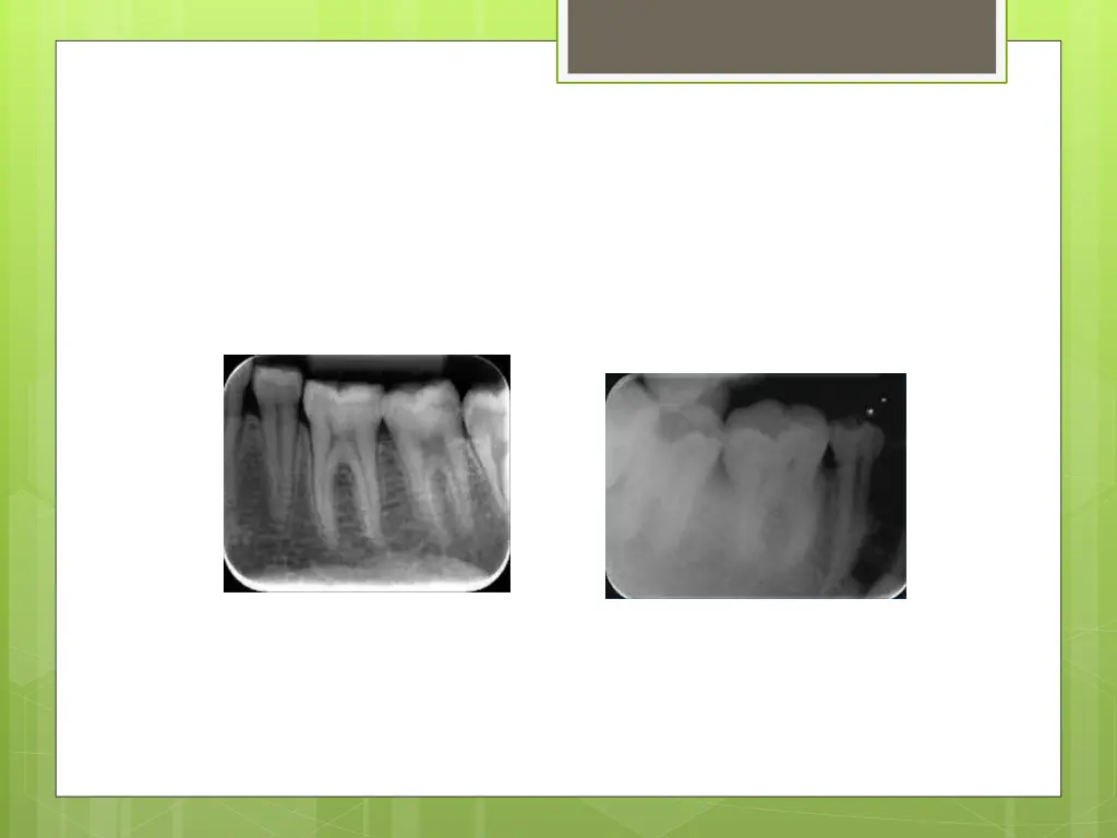 slide12