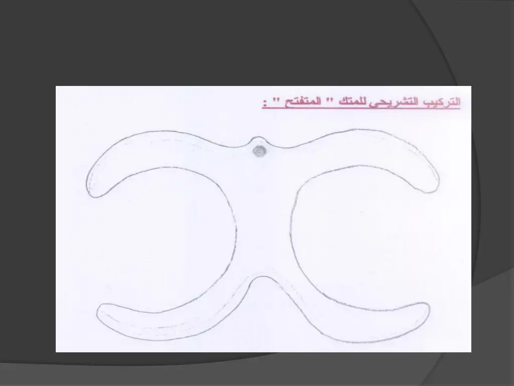 slide15