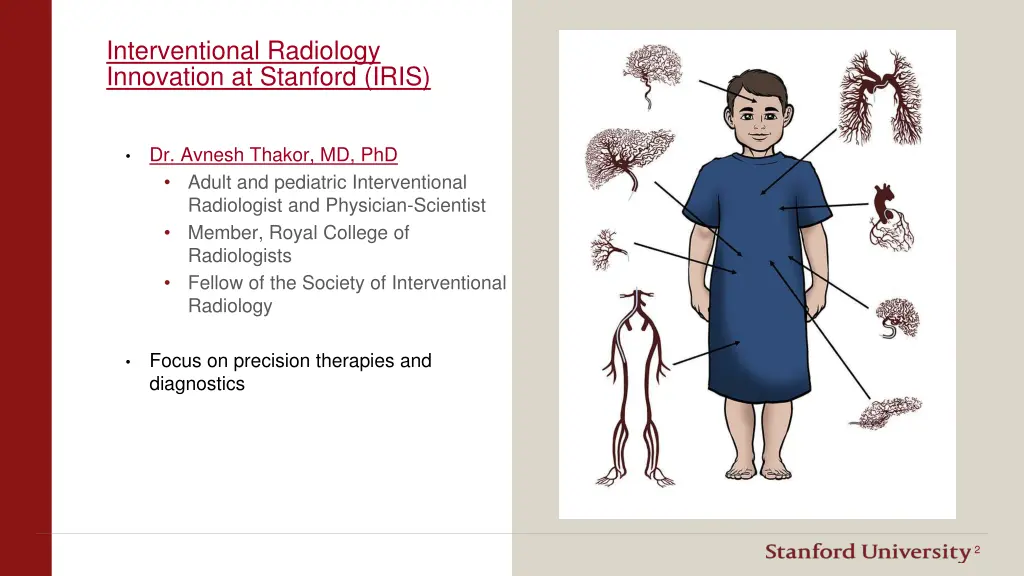 interventional radiology innovation at stanford