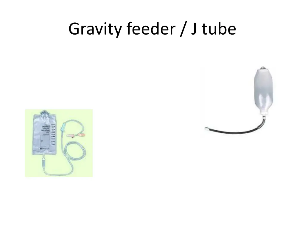 gravity feeder j tube