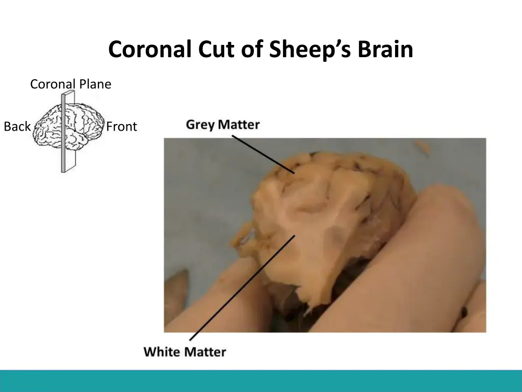 coronal cut of sheep s brain