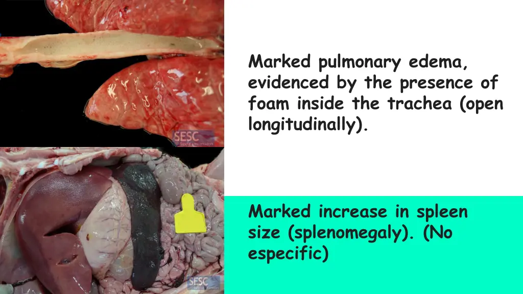 marked pulmonary edema evidenced by the presence