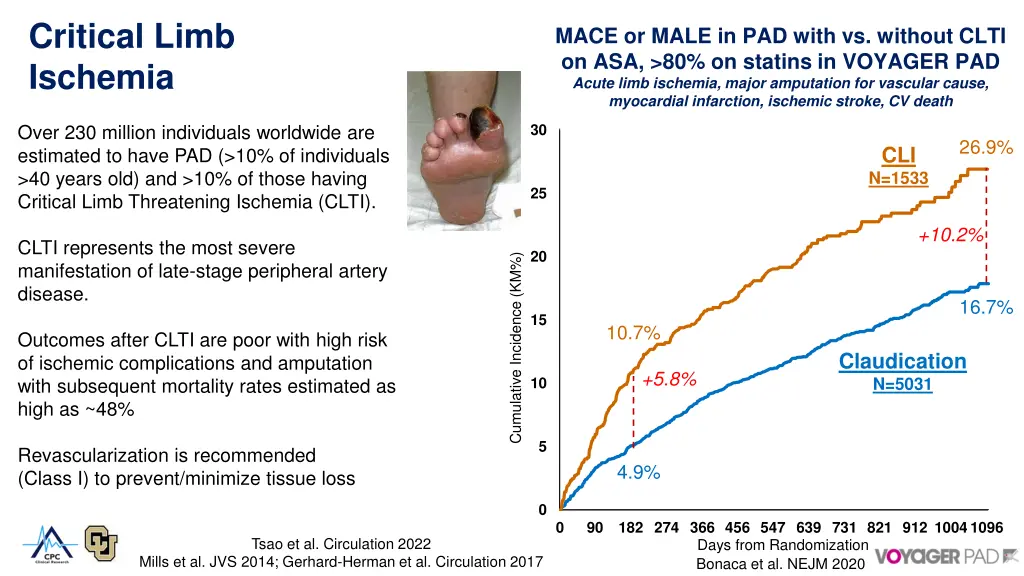critical limb ischemia