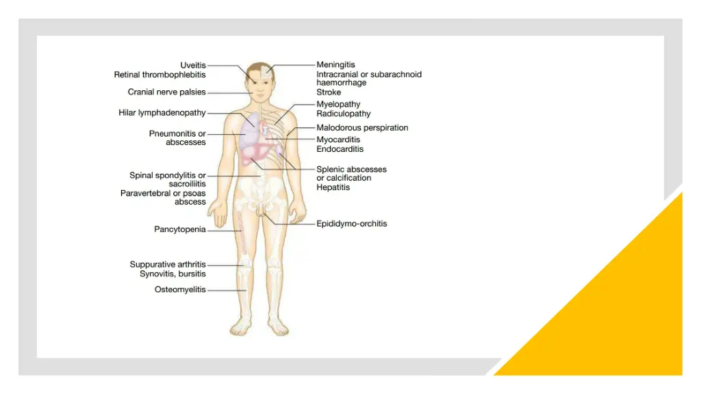 slide5