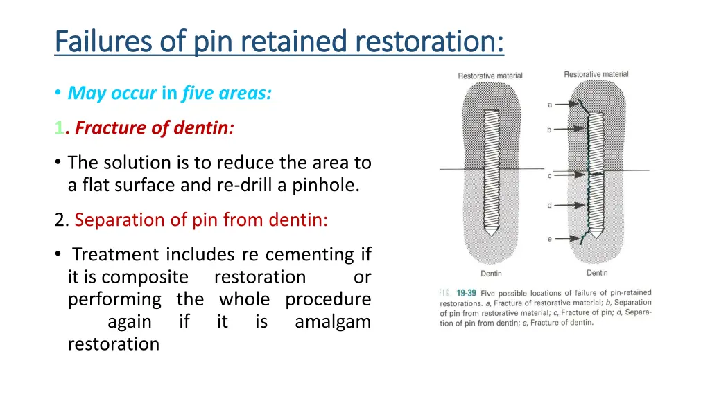 failures of pin retained restoration failures