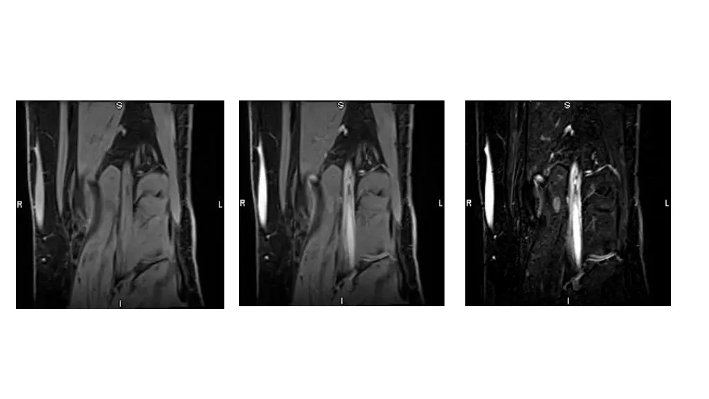slide11