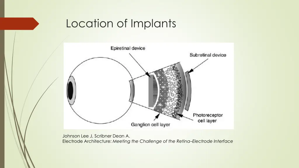 location of implants