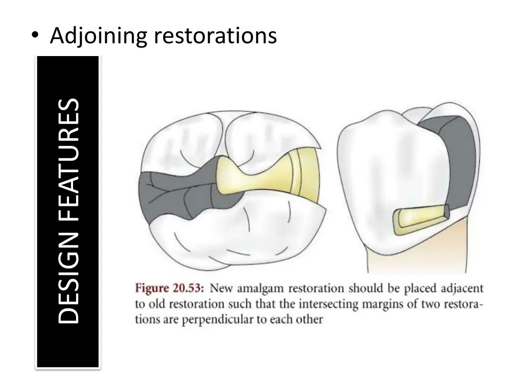adjoining restorations